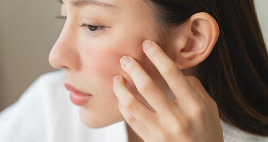 Why Does Your Skin Feel Dry Even After Skincare?